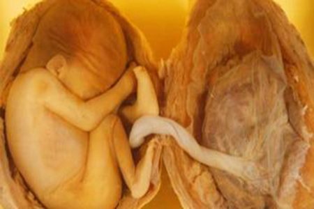 生完孩子胎盘怎么处理好,大家生完宝宝胎盘都怎么处理了