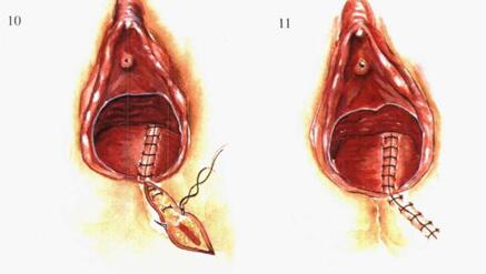 顺产真的好痛,顺产很疼