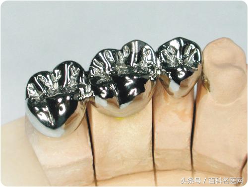 整牙可以变好看吗,整牙可以变成瓜子脸吗