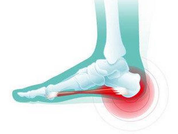 脚后跟摸着不疼踩着就疼是啥原因,走路多脚后跟疼是什么原因引起的