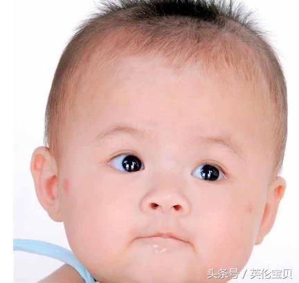 宝宝湿疹妈妈的心酸,宝妈湿疹的亲身经历