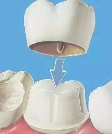 林允的牙怎么又恢复了,林允回应脸型变化她又变脸了吗