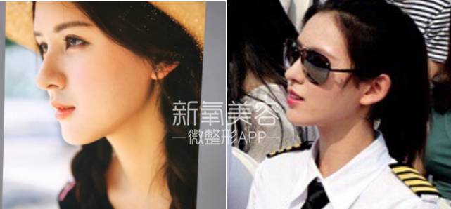 林允整牙却像整容？她是真的又整了啊！