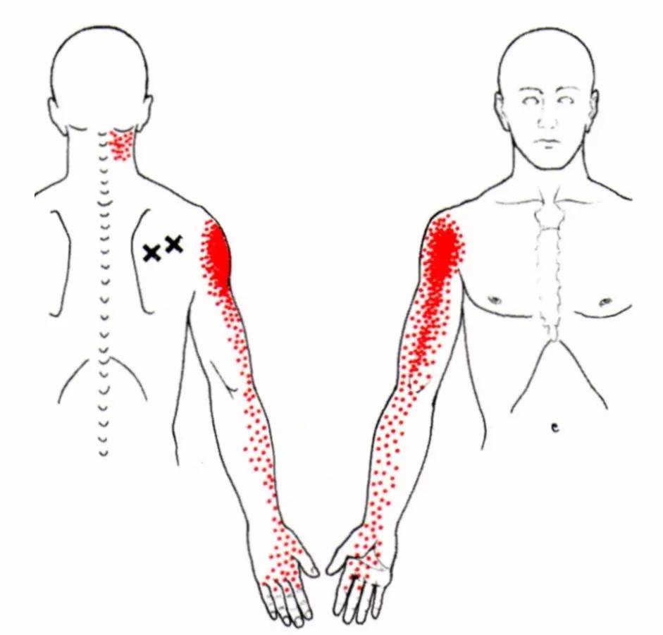 99%的上班族都“坐”出了工伤，你中枪了吗？