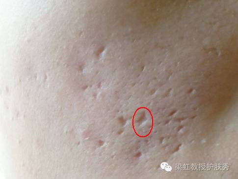 梁虹护肤品视频大全,梁虹教授护肤秀