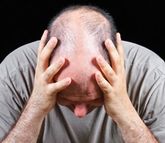 赵炳南治疗脂溢性脱发,赵炳南治疗脂溢性脱发的中药药方