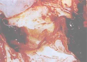 专家教你：如何判断牛气肿疽病与诊断方法？