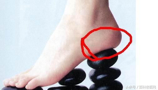脚后跟疼不走路也疼怎么回事,小孩脚后跟疼不红不肿是什么原因