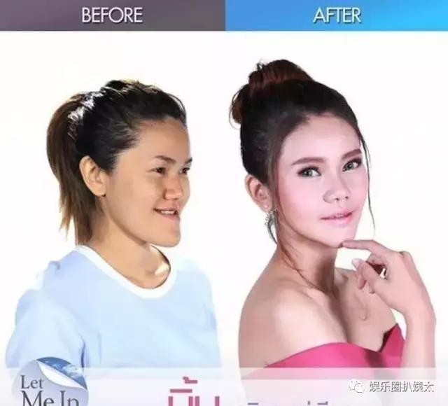 泰国专门的整容节目,泰国的整容节目有哪些