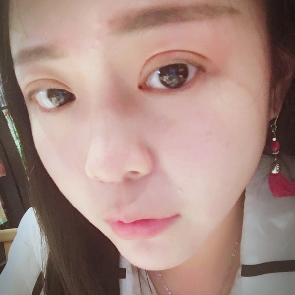 做完双眼皮眼睛像哭了一样,做完双眼皮哭了眼睛灰蒙蒙的