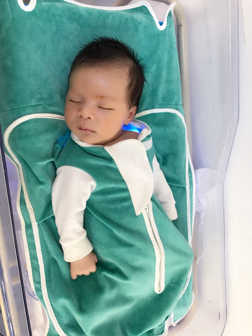 黄疸光晒能解决问题吗,与黄疸作斗争