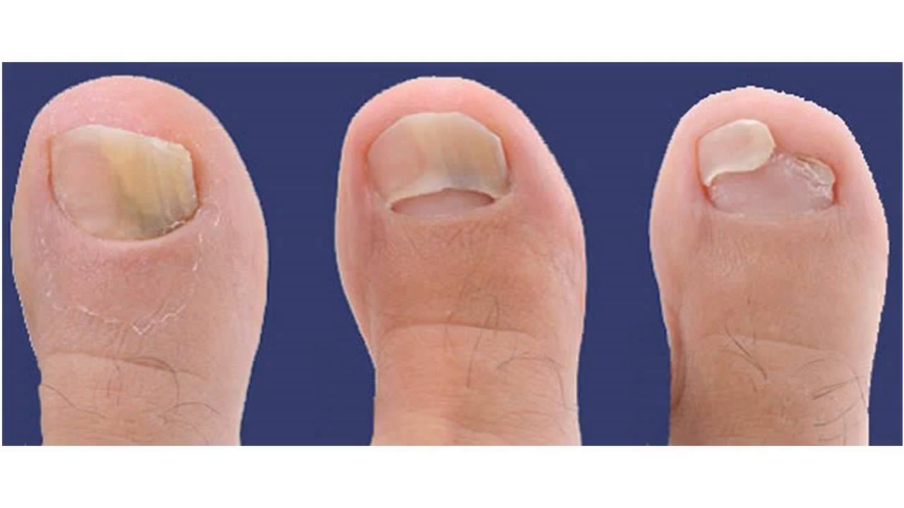 指甲都会有什么病症,指甲也会病变么