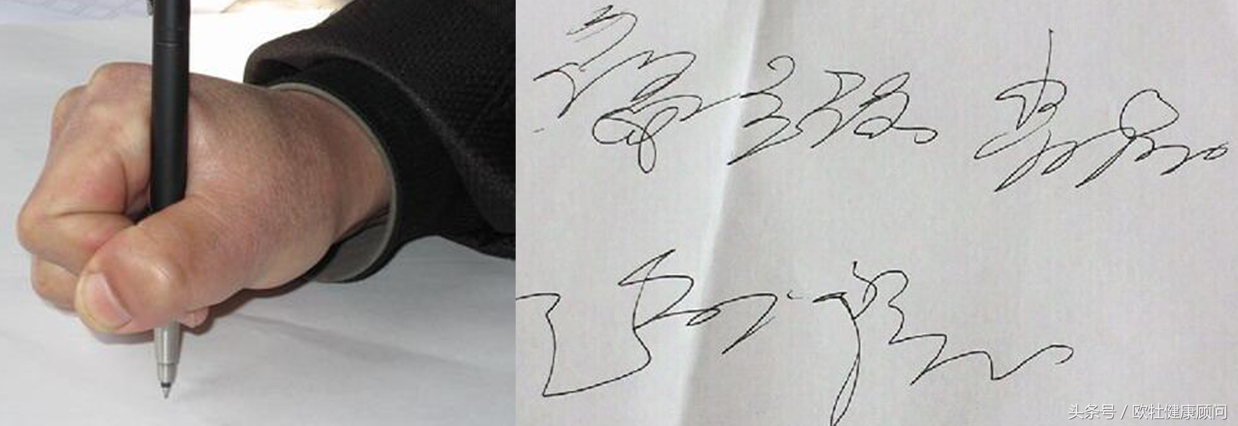 说不出来话是中风的前兆吗,说不出来话是脑血栓前兆