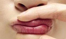 小孩嘴唇干裂是什么原因引起的,嘴唇干裂起皮鼻孔也干是什么原因