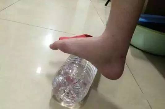 跟腱断裂术后康复时间表,跟腱断裂术后康复费用大约多少钱