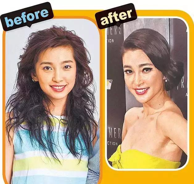 整牙刘涛,整牙改变脸型杨幂