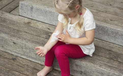 烫伤后不能吃什么,烫伤之后不能吃什么