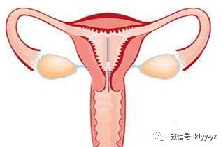 二胎备孕体检有哪些项目,二胎取环