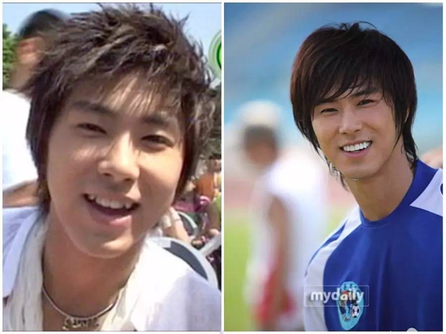 双眼皮手术韩式整形,韩国医生做幽灵手术