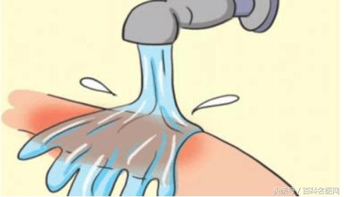 宝宝烫伤最佳的解决方法,宝宝烫伤的原因和处理方法