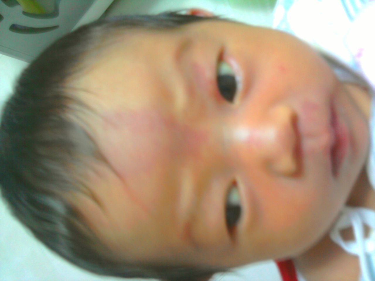 新生宝宝胎痣有什么说法,新生儿胎痣多是怎么回事