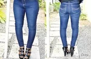 婴儿o型腿怎么矫正最有效的方法,o型腿怎么通过运动矫正