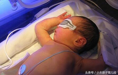 孩子被送医院治疗黄疸,刚出生的孩子有黄疸偏方