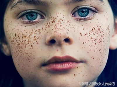 长斑皮肤的护理方案,皮肤长斑点