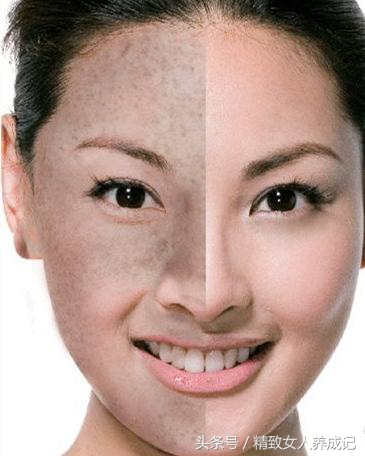 长斑皮肤的护理方案,皮肤长斑点