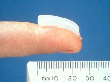 皮肤科医生和你聊聊那些含有激素的小软膏