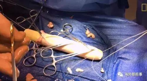 她允许摄影师跟拍变性全过程获得全家支持