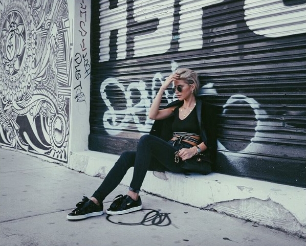 刘德华坠马前后,刘德华坠马是开刀还是保守治疗