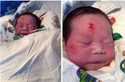 孕妇被车子撞了应该怎么赔偿,孕妇被撞胎儿死了该赔偿吗