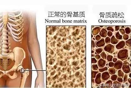 不到十块钱，护骨补钙秒杀牛奶，还富含矿物质！