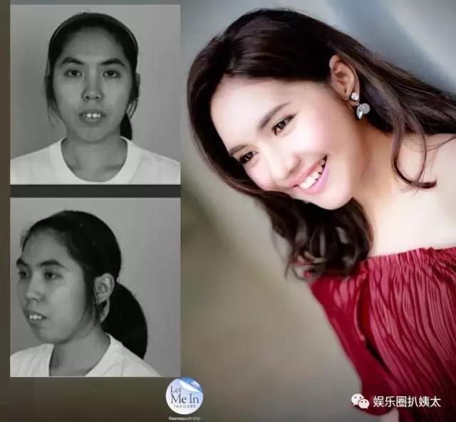 泰国专门的整容节目,泰国的整容节目有哪些