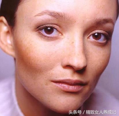 长斑皮肤的护理方案,皮肤长斑点