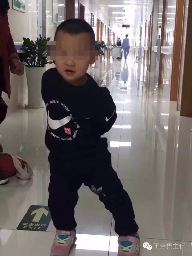 脑瘫孩子正常走路的方法,小儿脑瘫针刀治疗视频