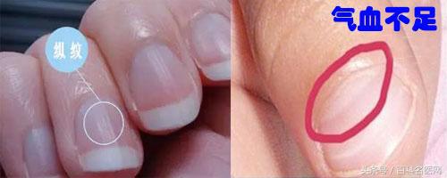 自测气血不足小妙招,如何看气血不足在身体的表现