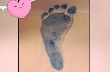 林心如剖腹产经历,林心如是顺产还是剖腹产