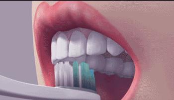 蛀牙牙疼松动疼痛难忍能拔掉吗,蛀牙牙疼刷牙能缓解吗