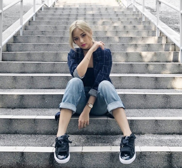 刘德华坠马前后,刘德华坠马是开刀还是保守治疗