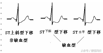 郭雅卿心电图讲解全集,郭雅卿血汗管视频课