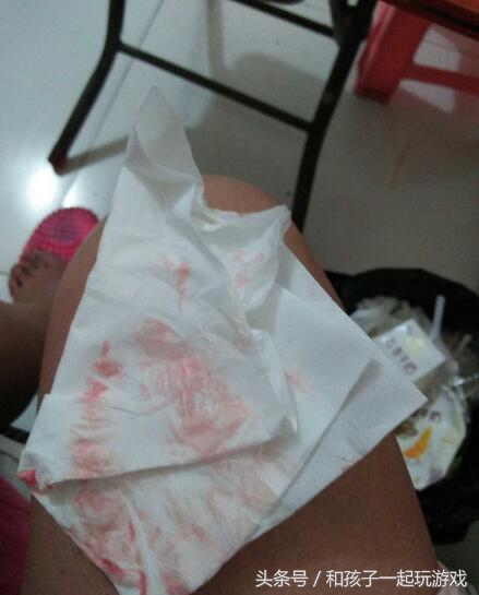 孕早期宫内出血能保住吗,怀孕早期出血辨别宫内还是宫外