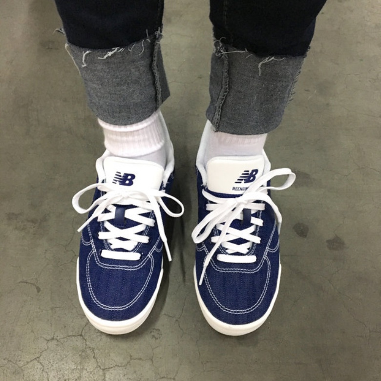 刘德华坠马前后,刘德华坠马是开刀还是保守治疗