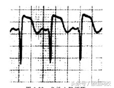 郭雅卿心电图讲解全集,郭雅卿血汗管视频课