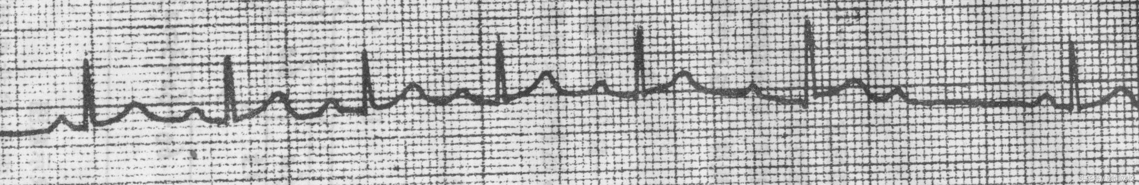 郭雅卿心电图讲解全集,郭雅卿血汗管视频课