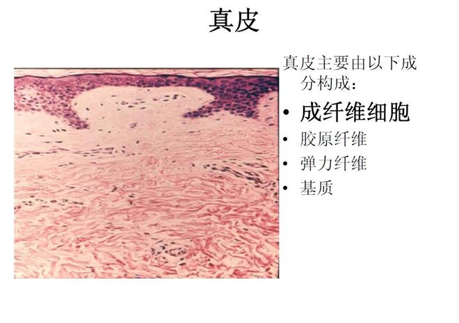 微针治痘坑涂碘伏,微针对深痘坑有效吗
