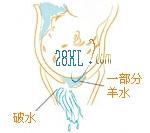 分娩前兆有哪些,啥叫分娩前的前兆