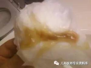 儿童鼻涕的秘密,儿童黄鼻涕粘稠