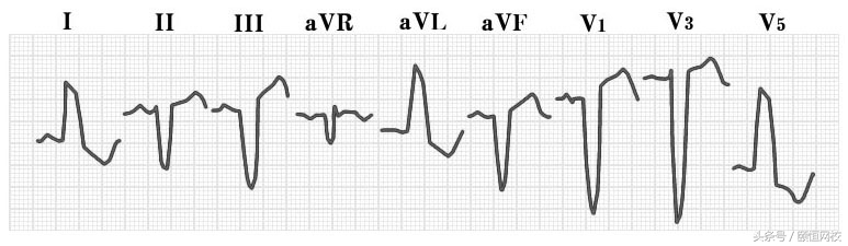 郭雅卿心电图讲解全集,郭雅卿血汗管视频课
